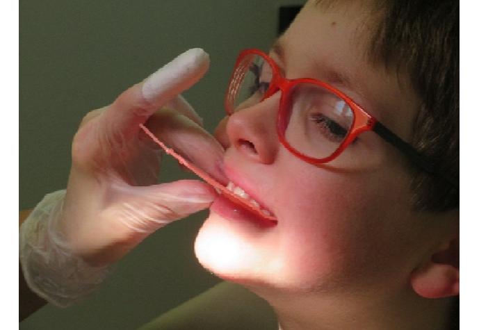 טיפול שיניים מותאם לילדים עם הפרעת קשב והיפראקטיביות 